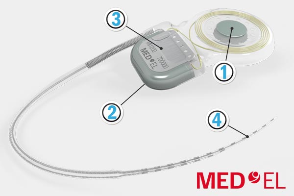 L'Implant Med-El Synchrony